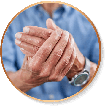 Neuropatia Diabética